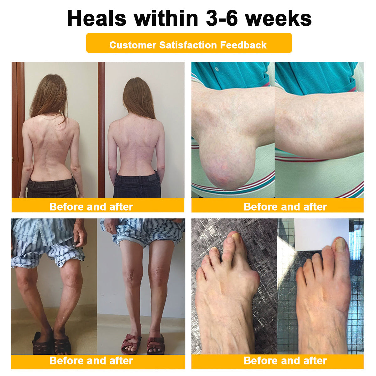đĽTime-Limited Offer - ODALIT⢠Botulinum Toxin & Bee Venom Pain-Relief Bone Healing Creamđđ