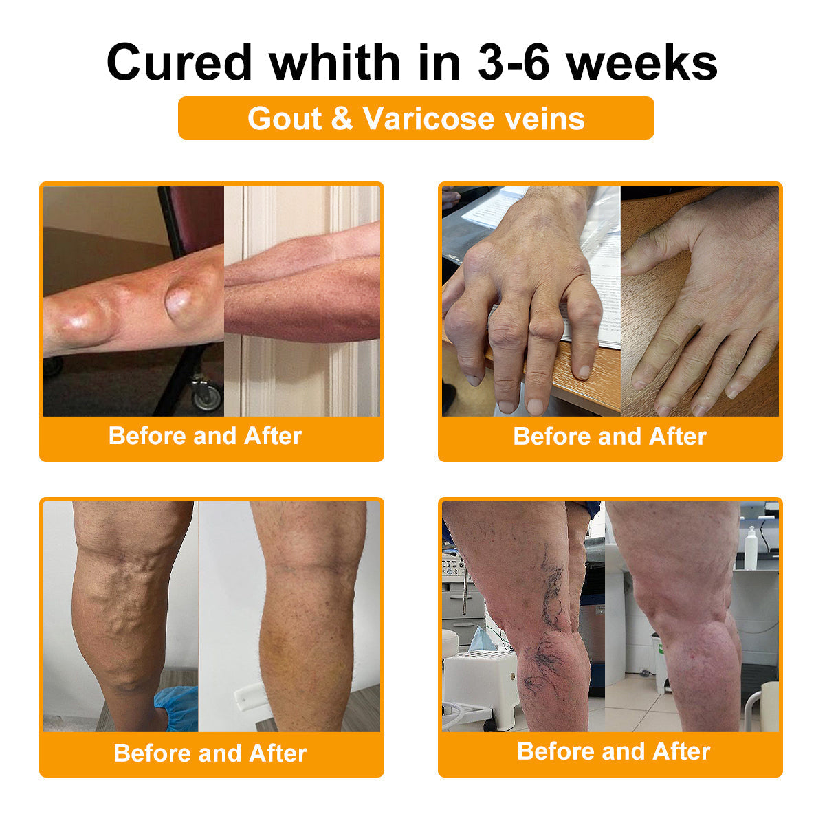 đĽTime-Limited Offer - ODALIT⢠Botulinum Toxin & Bee Venom Pain-Relief Bone Healing Creamđđ